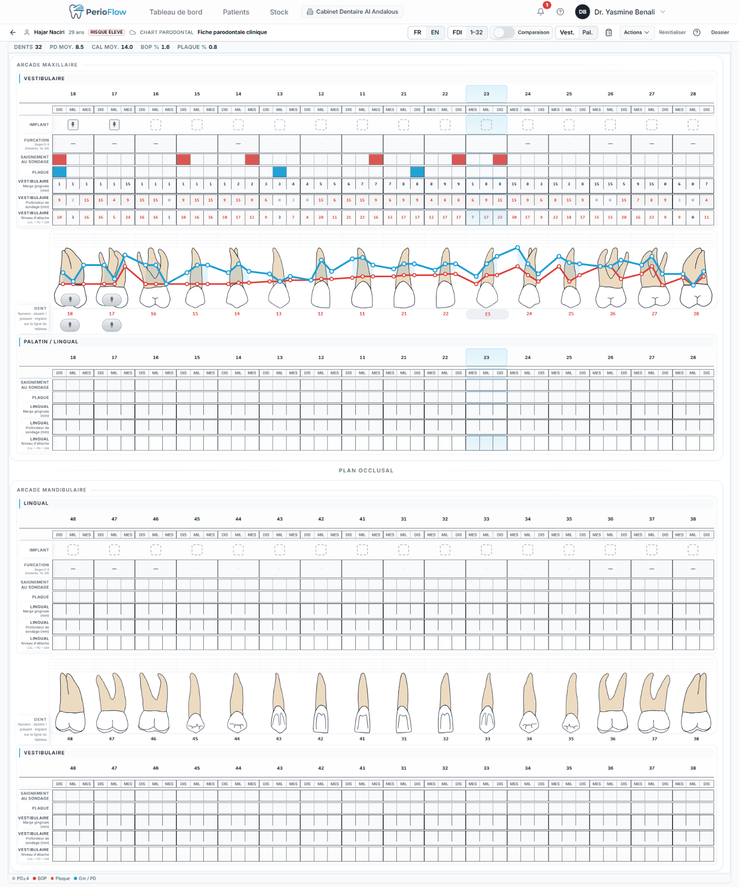 PerioChart Pro: Periodontal chart — the clinical core