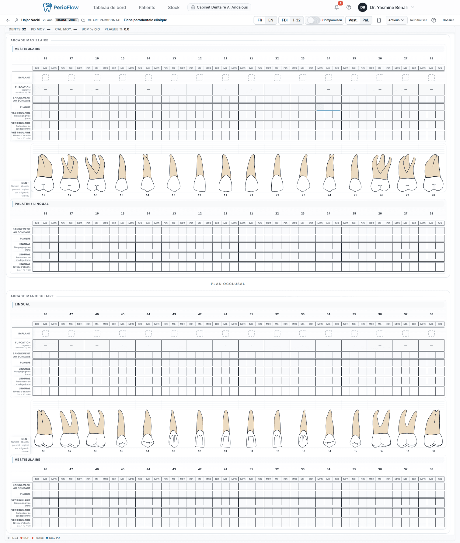 PerioChart Pro: Periodontal chart — the clinical core